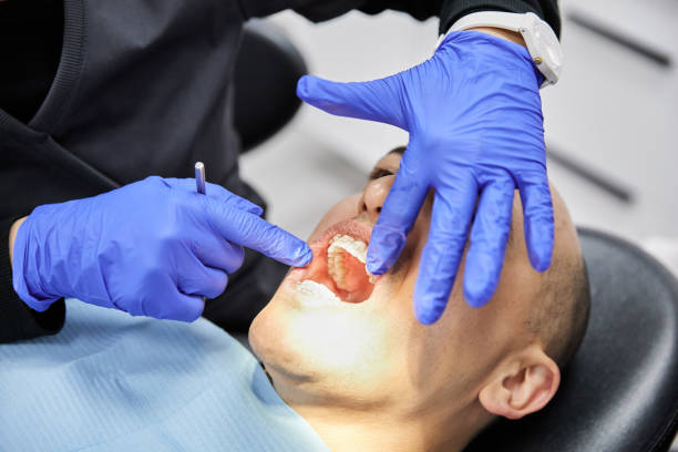 Best Emergency Tooth Extraction in Riverside, UT